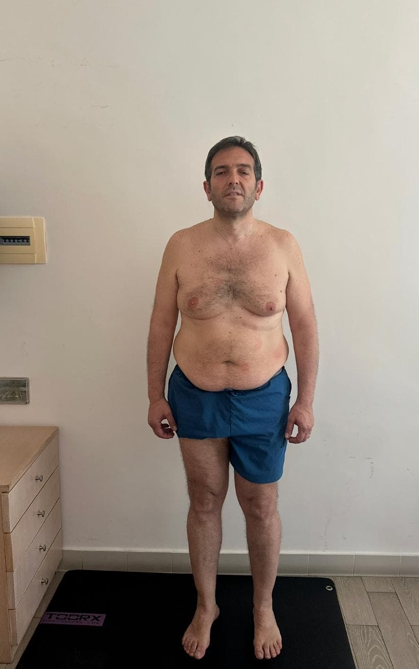 Domenico 52 anni — dopo