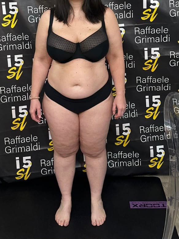 Valeria 43 Anni — dopo